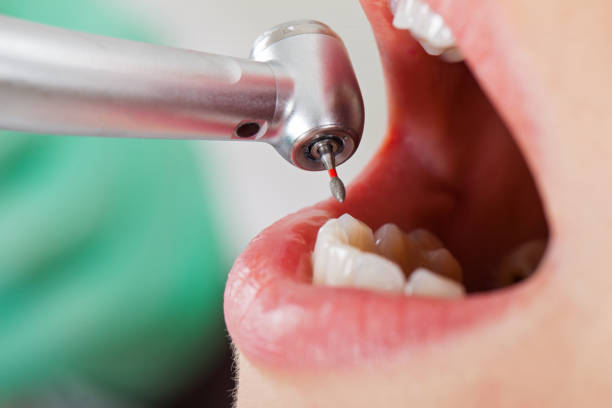 Emergency Gum Pain Relief in WV
